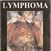 Lymphoma / Digestive Mucosa Reflux