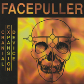 Cranial Expansion Device