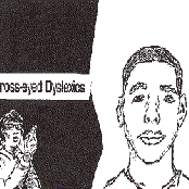 Cross Eyed Dislexics