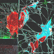 theyhungusfrompowerlines [Explicit]