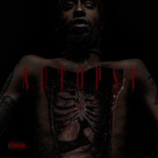 Autopsy