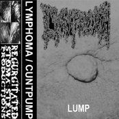 Lump / Perverted Hysterectomy