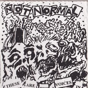 These Are The Voices In The Back Of Your Head