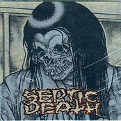 Dysentery by Septic Death