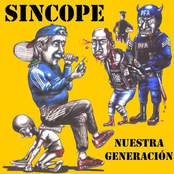 Sincope