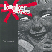 Fleshy Headed Mutant