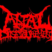 anal disfigurement