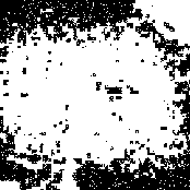 BRAIN CHEMESTRY IMBALANCE