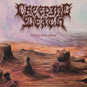 Creeping Death: Intestinal Wrap