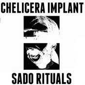 Sado Rituals / Chelicera Implant