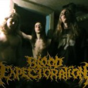 Blood Expectoration