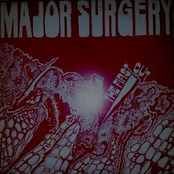 Major Surgery