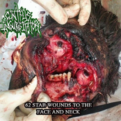 62 Stab Wounds To The Face And Neck
