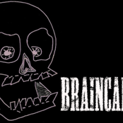 braincancer