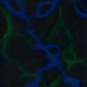 Trading Alienation for Anesthesia