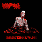 Severe Pathological Violence
