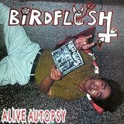 Alive Autopsy by Birdflesh