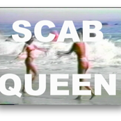 Scab Queen