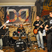 dentband