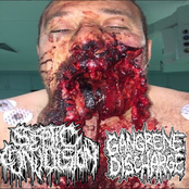 Septic Convulsion / Gangrene Discharge