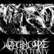 The Wretched Corpse Anatomy