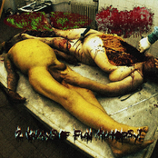 2 Ways of Fun Autopsy!