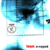 Target X-rayed