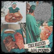 Tumor measuring 100 pound