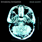 Breaking Benjamin: Dear Agony
