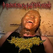Tortures Now For Half Fecal Metods