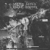 Endobronchial Matastasis Of Osteosarcoma Presenting As Position Dependent And Variable Airway Obstruction Of The Trachea