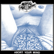 Abort Your Mind