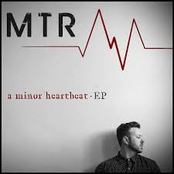 A Minor Heartbeat