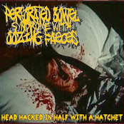 Head Hacked in Half With a Hatchet
