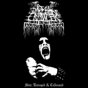 Skin Ravaged & Calloused