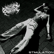 Stimulation