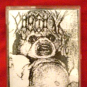 Mastectomia / Vômito