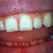 FUCKSHITUP (OLD SCHOOL EXTREME TERRORCORE GABBER)