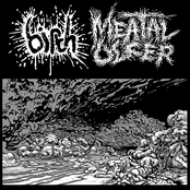 Meatal Ulcer / Birth