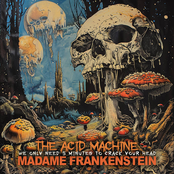 We only Need 5 Minutes To Crack Your Head