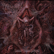 Aberrant Vaginal Gestation