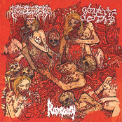 Rampancy / Granulocytic Blastoma / Bowel Stew