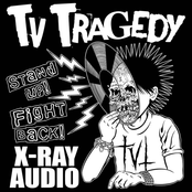 X-Ray Audio