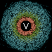 V