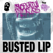 Busted Lip