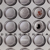 Dysrhythmia: Pretest