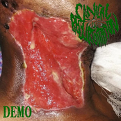 Clinical Regurgitation demo