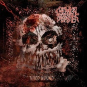 Third Wound
