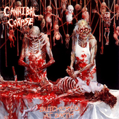 Living Dissection by Cannibal Corpse