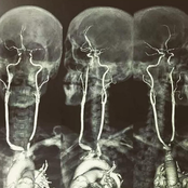 22.حنين.ɐɓoɐ ǝs ıɐǝl؛////